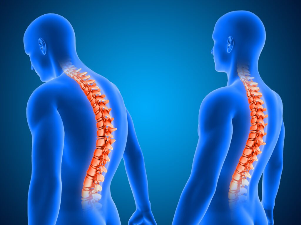 Best Spine Surgeon in Jalandhar.